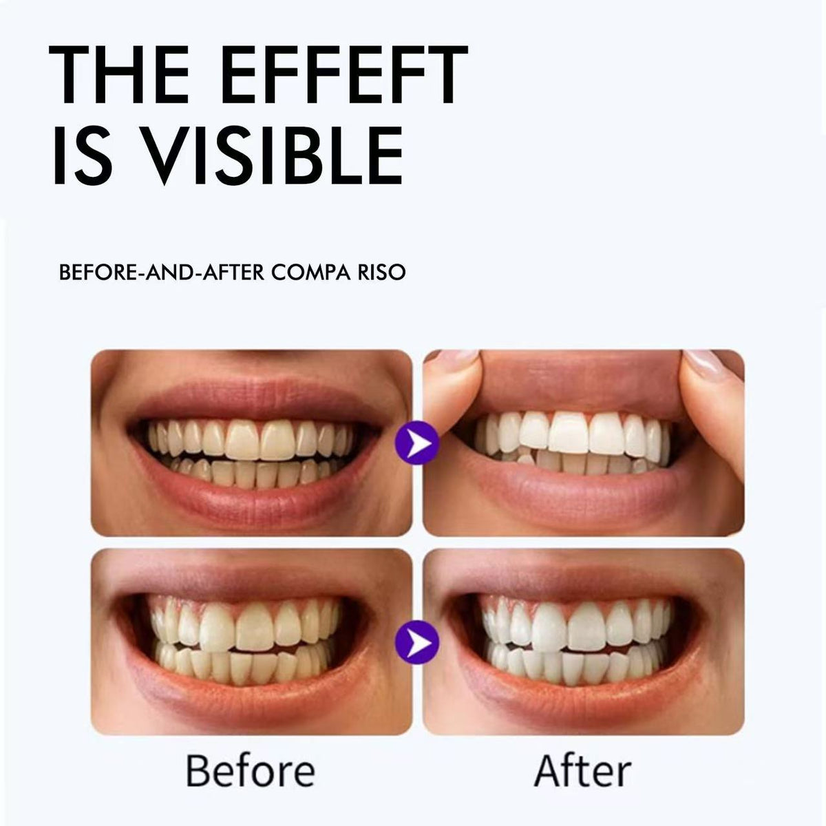 Purple Teeth Whitening Strips - 7/21 Whitening Sessions - Non Sensitive Teeth Whitening - Peroxide-Free