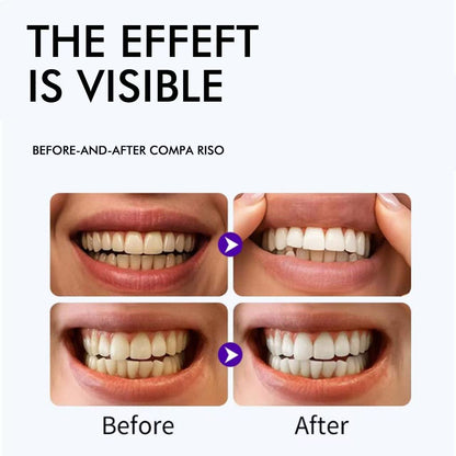 Purple Teeth Whitening Strips - 7/21 Whitening Sessions - Non Sensitive Teeth Whitening - Peroxide-Free